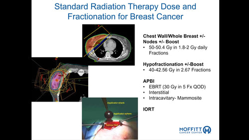 Breast Radiotherapy: Basic Principles and Evidence for Management