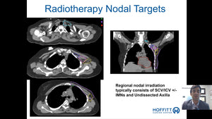 Breast Radiotherapy: Basic Principles and Evidence for Management