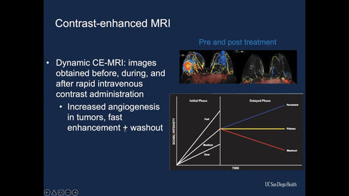 Breast Diffusion Weighted Imaging - Efficiency Learning Systems