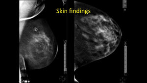 Digital Breast Tomosynthesis with Dr. Ojeda-Fournier - Efficiency Learning Systems