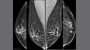 Breast Tomosynthesis: Initial Modality Training for MQSA