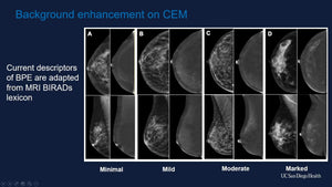 Contrast Enhanced Mammography: Techniques and Indication