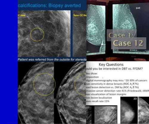 Breast Tomosynthesis: Initial Modality Training for MQSA - Efficiency Learning Systems