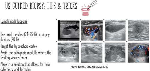 Ultrasound-guided Breast Biopsies - Efficiency Learning Systems