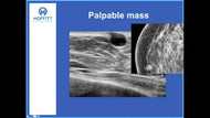 Breast Ultrasound: Interesting Case Presentations - Efficiency Learning Systems