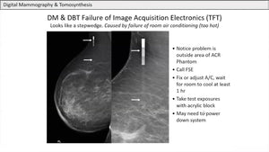 Digital Mammography & Tomosynthesis: Principles and Practical Aspects with recent improvements - Efficiency Learning Systems
