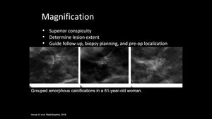 Everything you Wanted to Know About Calcifications